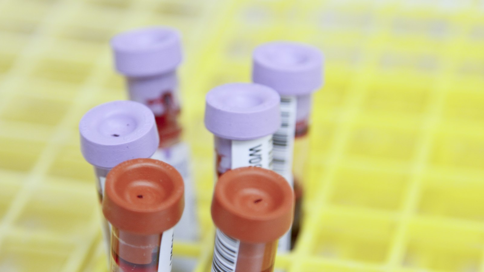 Probówki z próbkami krwi w laboratorium diagnostycznym